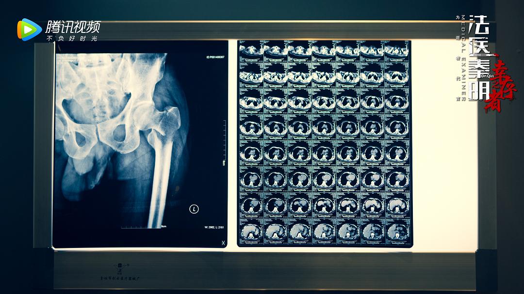 《法医秦明之幸存者》剧照