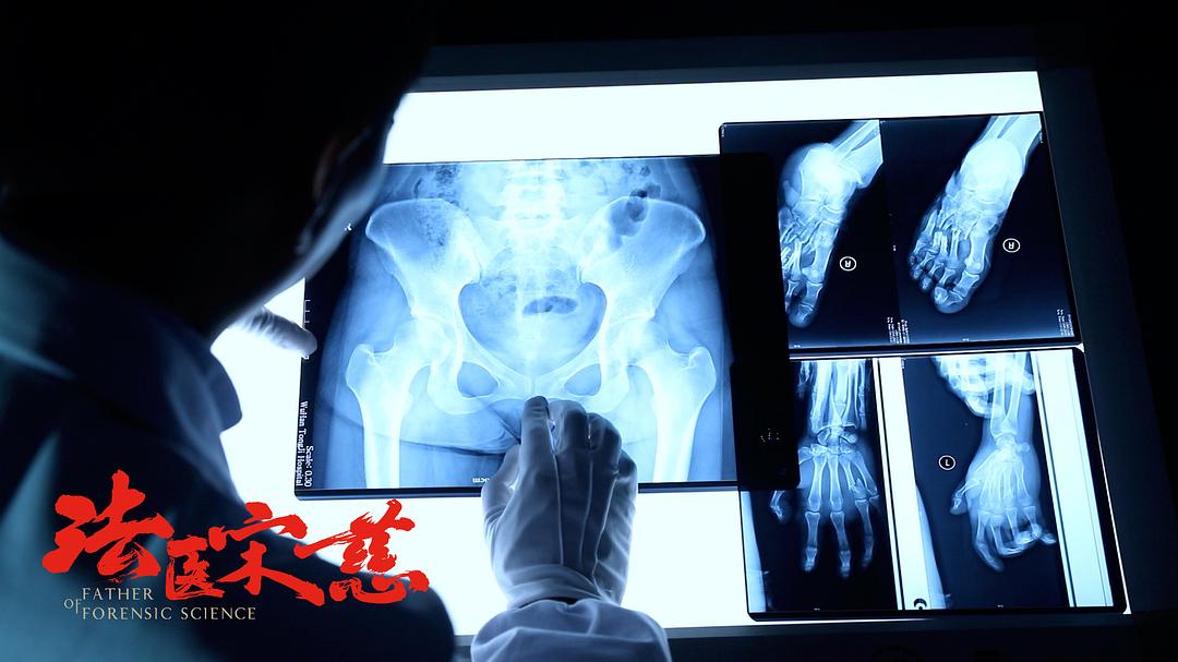 《法医宋慈》剧照第24张图片